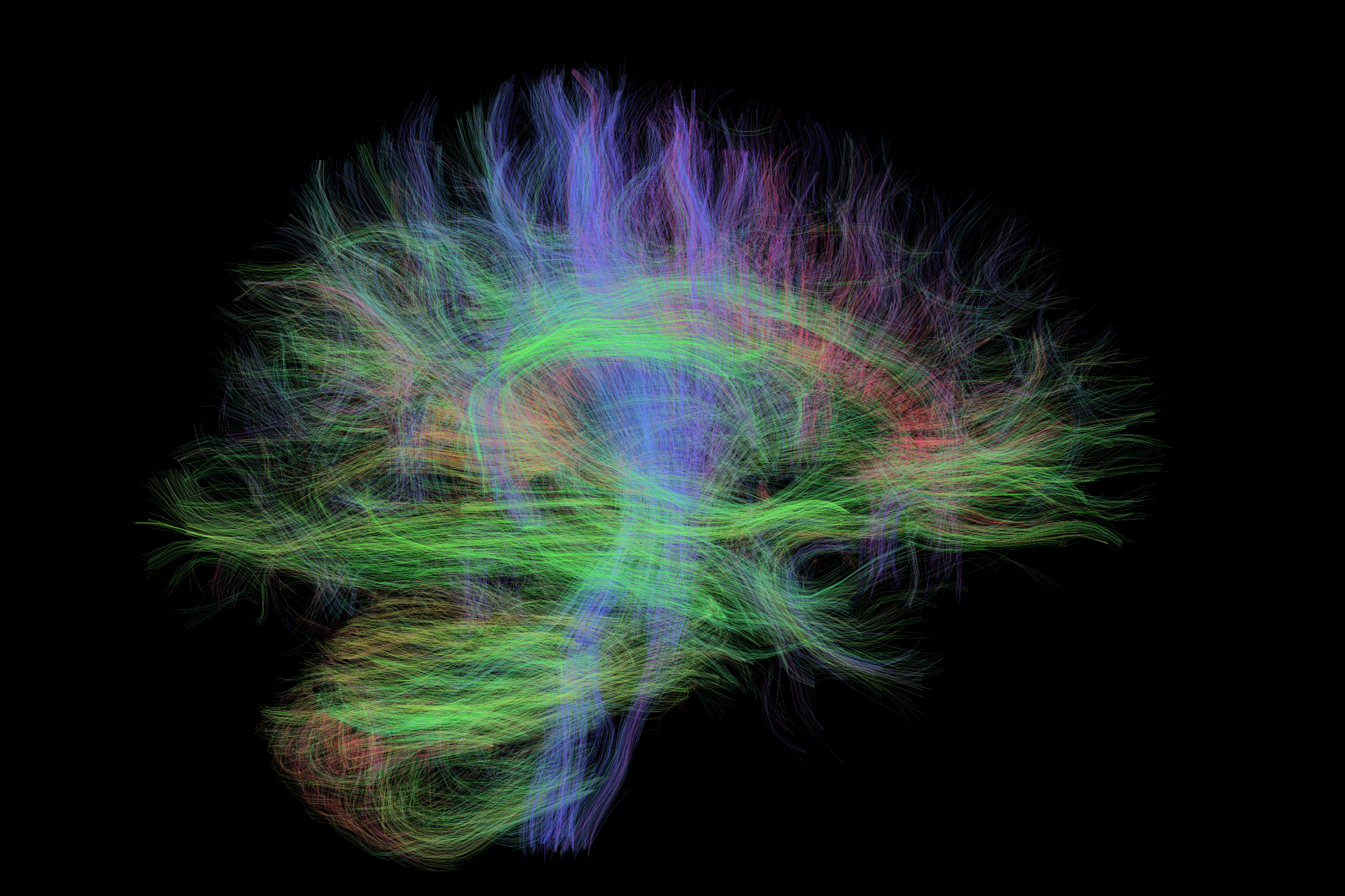 Image from a Diffusion-weighted imaging (DWI) scan showing white-matter nerve fibre pathways in the brain.