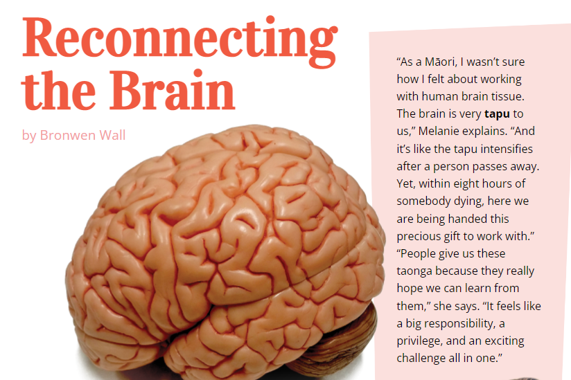 Image of a Brain