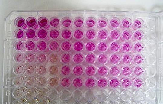 Tray of nitric oxide assay samples.