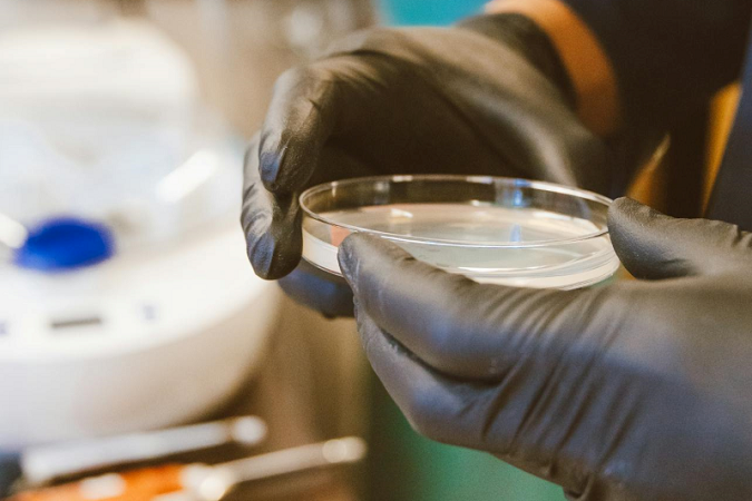A person wearing black gloves is holding an agar plate.